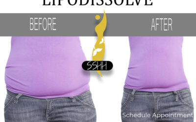 LipoDissolve