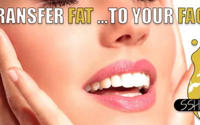 Fat Transfer-Let’s Move Your Fat To Your Face!