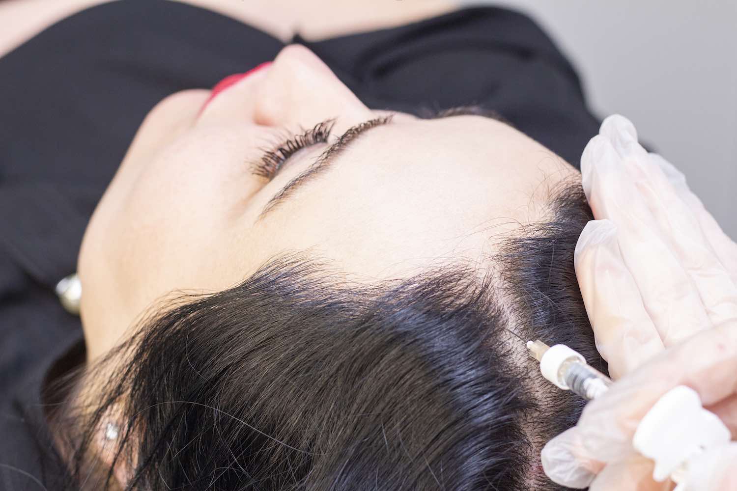 PRP Hair Restoration Scottsdale Medspa