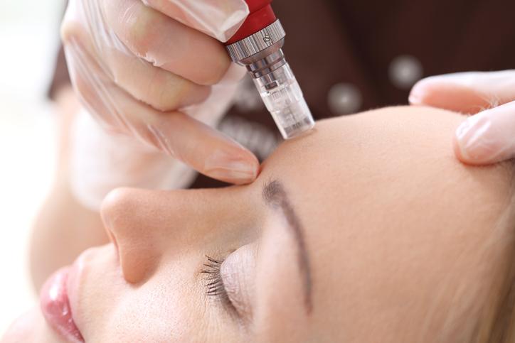 RF and Microneedling Special