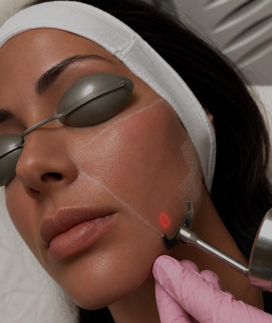 ProFractional Laser August Special