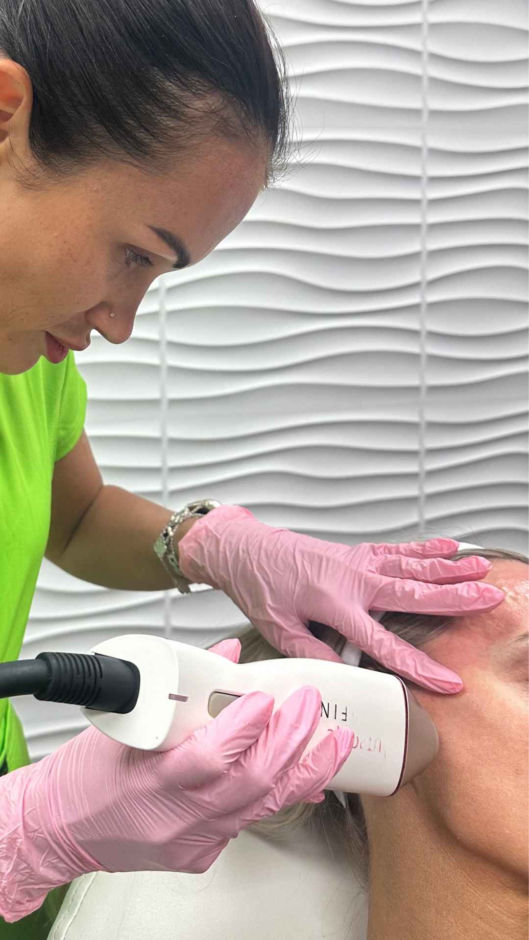 RF Microneedling in Scottsdale
