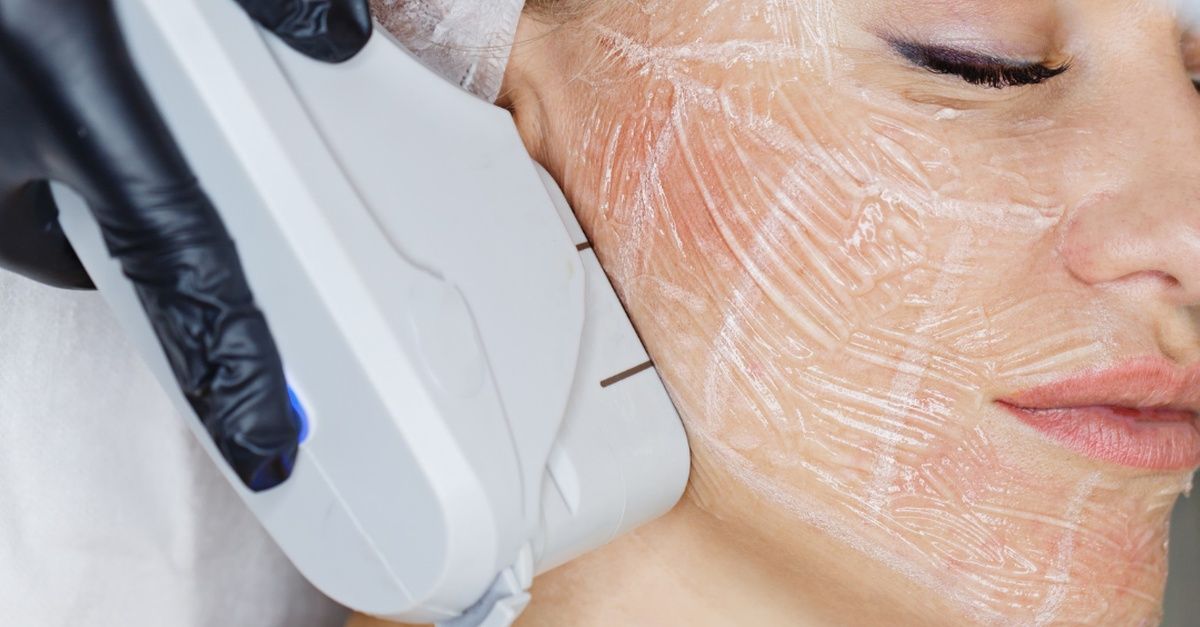 Ultherapy August Special at Scottsdale Skin and Holistic Health