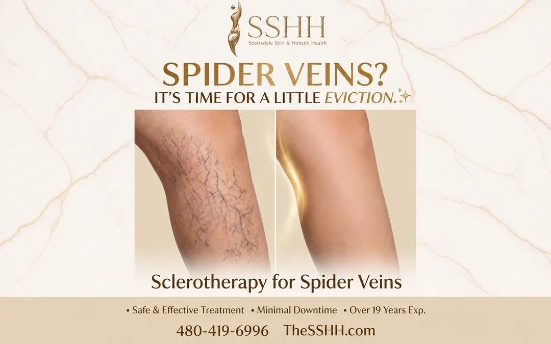 Remove Spider Veins in Scottsdale