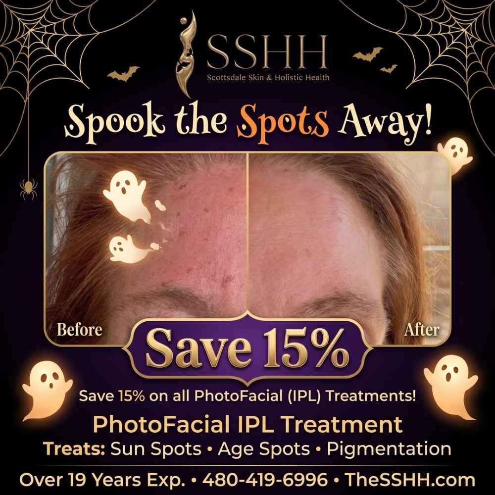 Photofacial IPL Treatment Specials in Scottsdale Photofacial IPL Treatment Specials in Scottsdale
